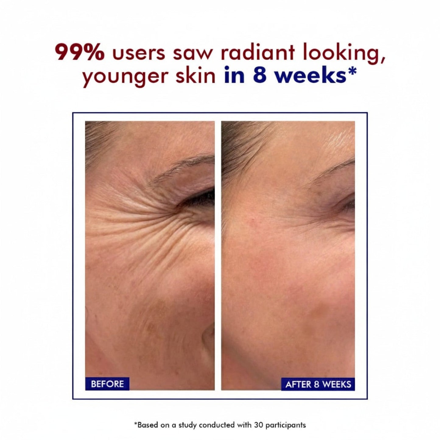 DeeperDots Retinol Ceramide Skin Barrier Repair Cream